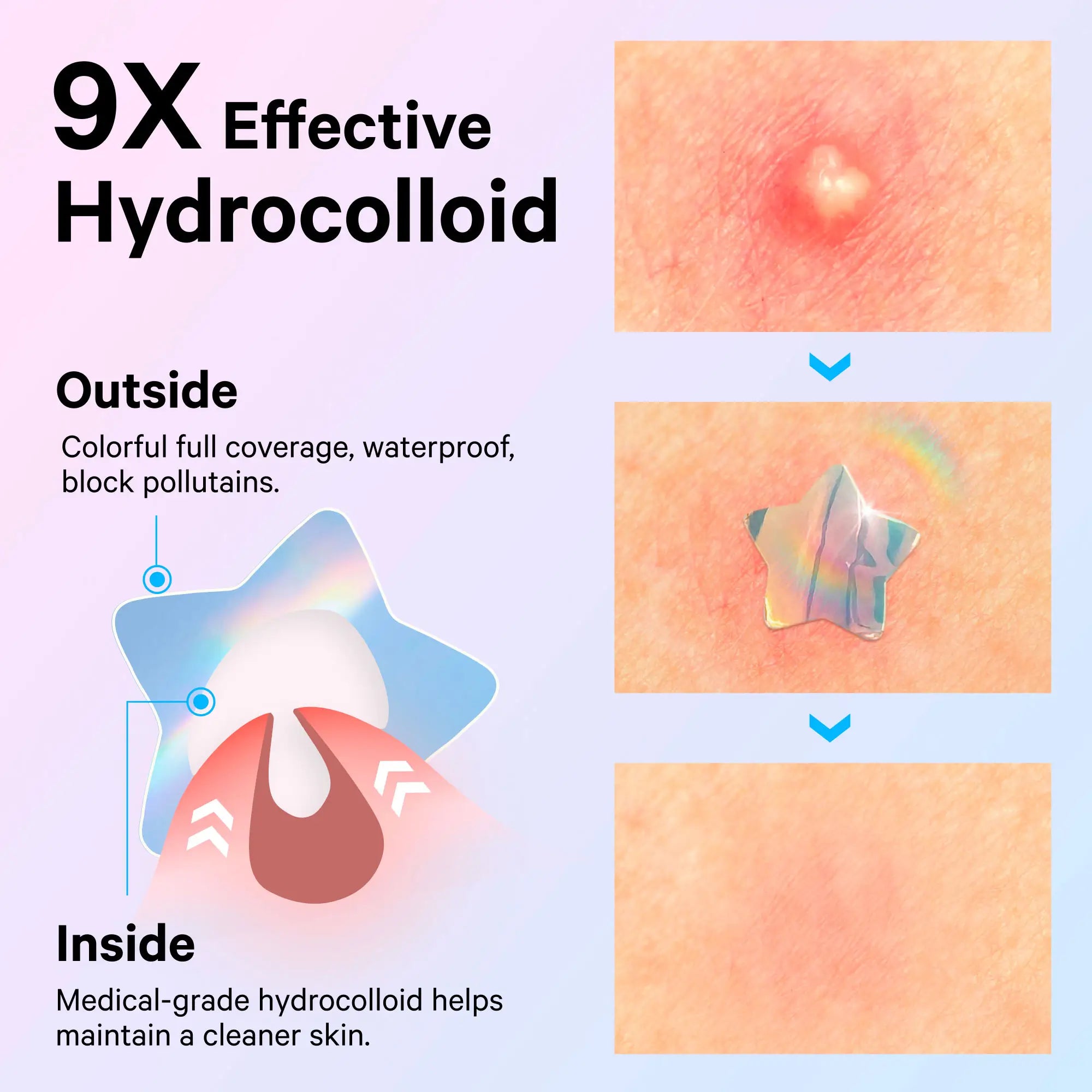 Cute+Hologram Hydrocolloid Pimple Patches--Multi-Shape(72pcs)