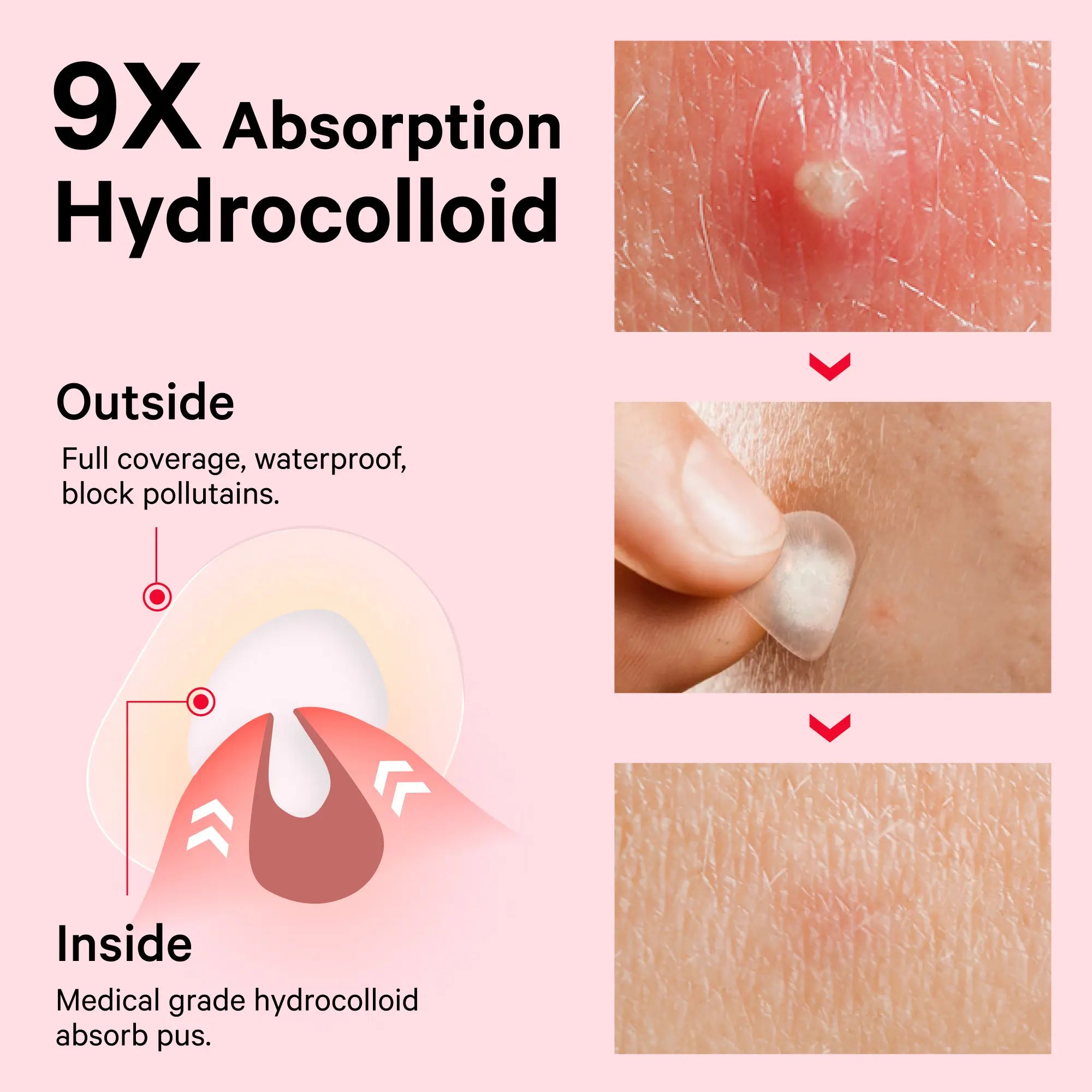 Hydrocolloid Invisible+ Pimple Patches