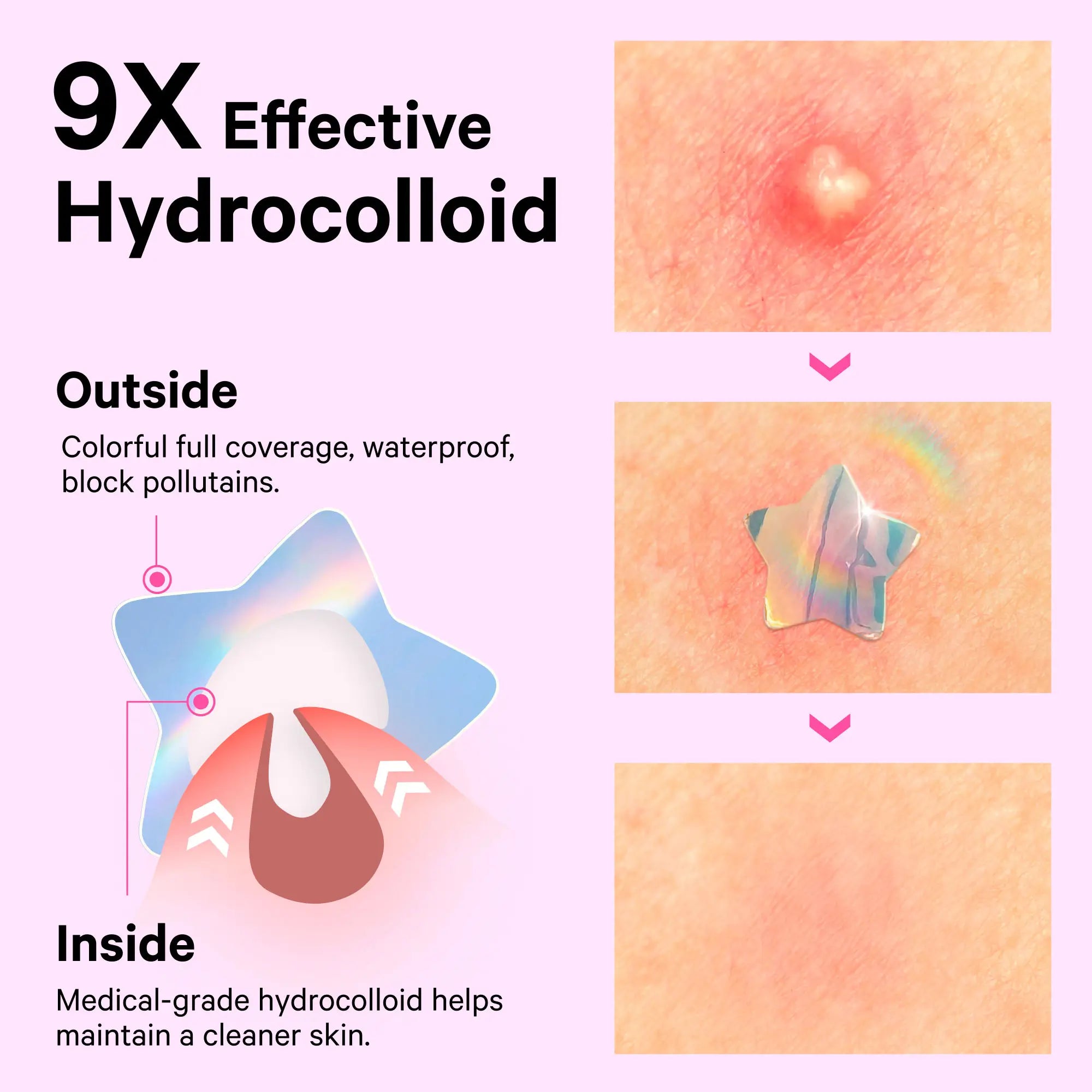 Cute+Hologram Hydrocolloid Pimple Patches--Triple-Shape