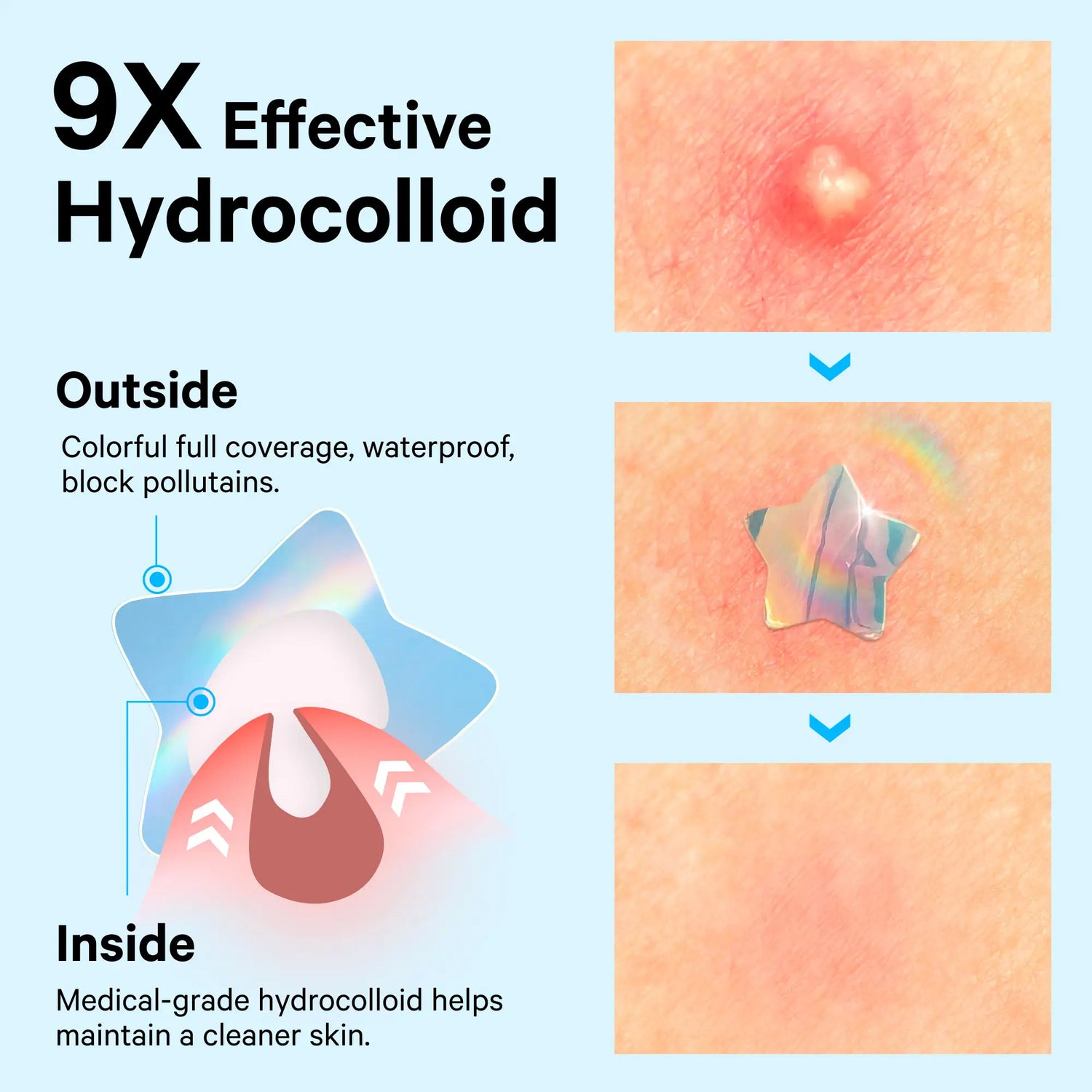Cute+Hologram Hydrocolloid Pimple Patches--Single-Shape